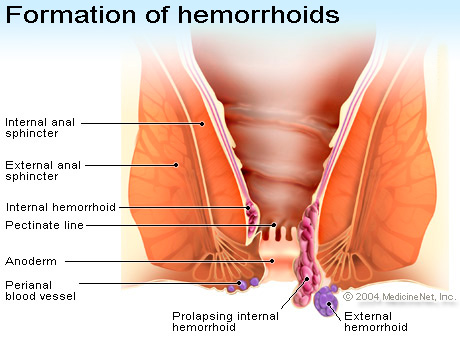 Over The Counter Medication For Hemorrhoids